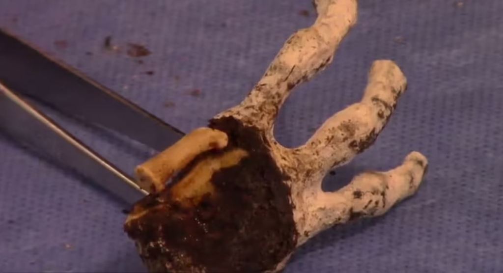 EXCLUSIVE: Experts studying ‘alien mummies’ from Peru make startling find while dissecting their&nbsp;bodies