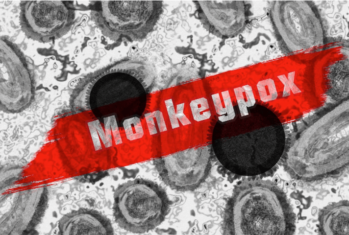 The Much Deadlier New Strain Of Monkeypox Has Now Reached The United&nbsp;States